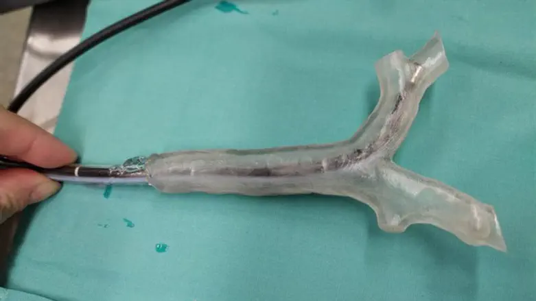 הניתוח עבר בהצלחה