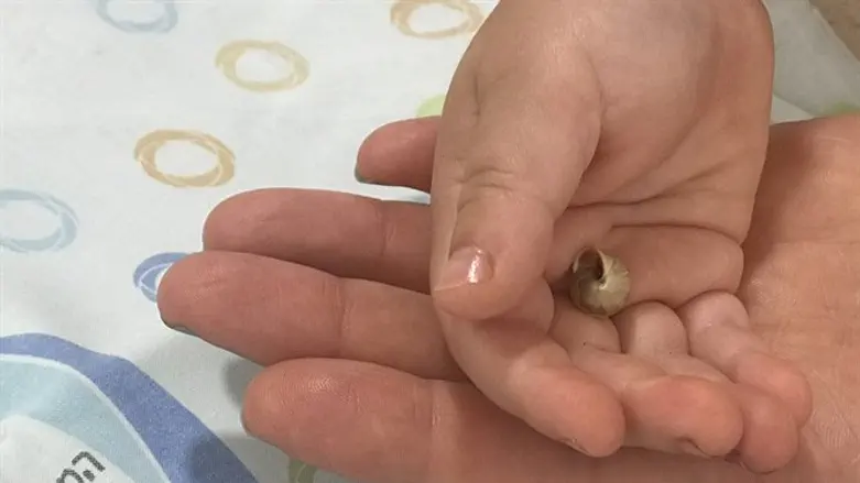 הפעוט מחזיק את החילזון שחולץ מאפו