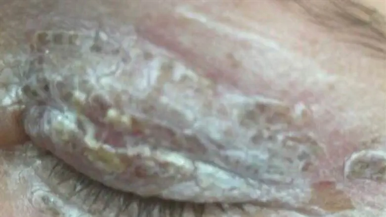 תוצאות קשות