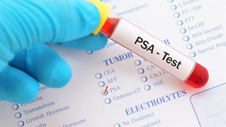 אילוסטרציה