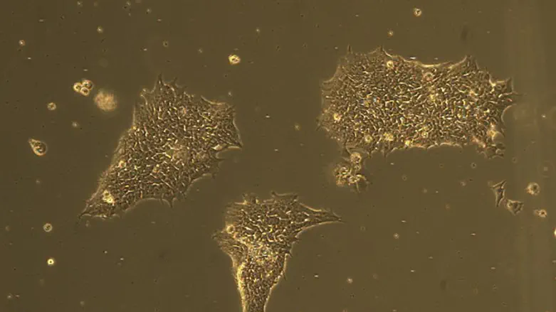 תאי גזע מתמיינים לנוירונים ומושבת תאי גזע לא ממוינת