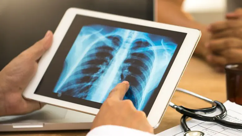 אילוסטרציה