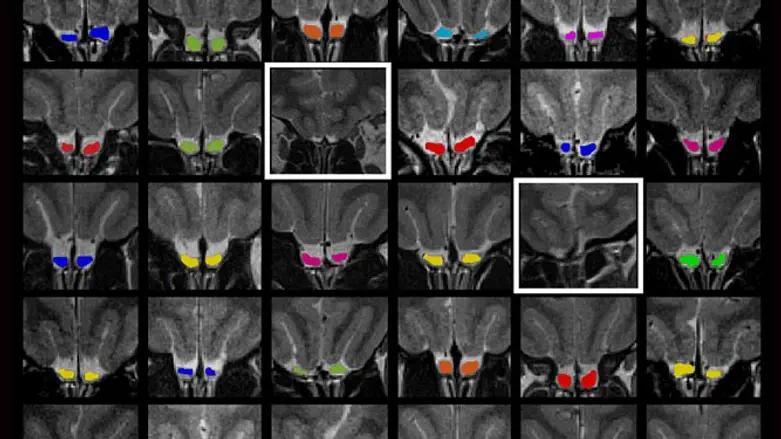 שמאל, ימין וחוש הריח 