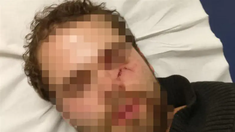 Избитый в Париже