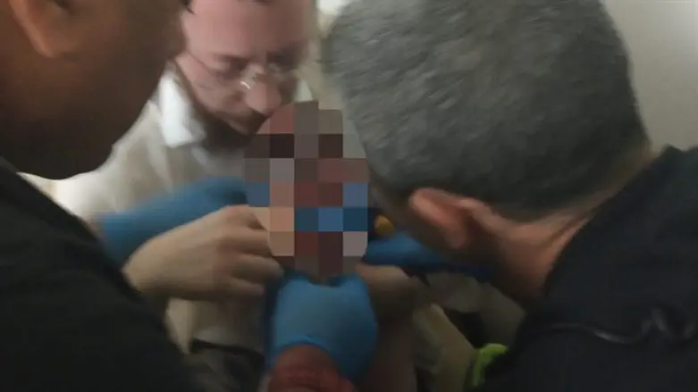 כבאים חילצו יד של פעוטה באמבטיה