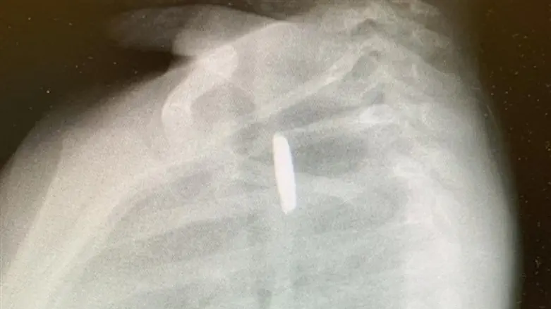 סוללה בוושט