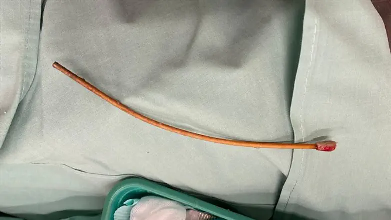 המטופל ניצל מחנק