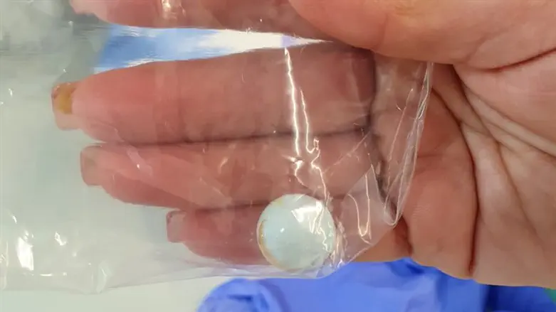 הגולה שחנקה את הפעוט