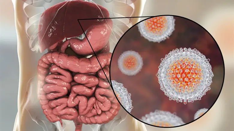Hepatitis C