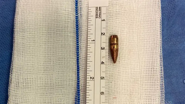 קליע חולץ מראשו של בן 9