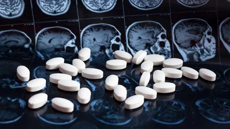 Alzheimer's disease