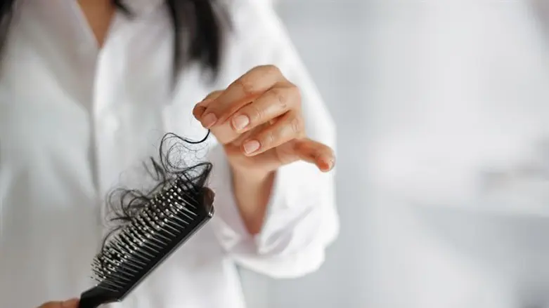 Выпадение волос