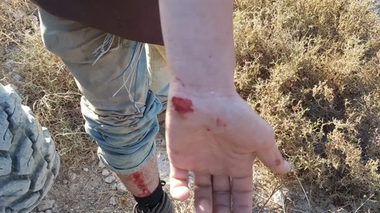 אחד הנערים שהותקף