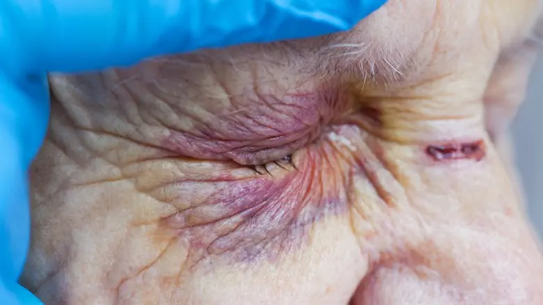 Illustration (archive)