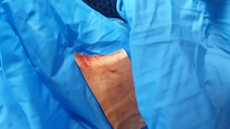 Палка, извлеченная из горла ребенка