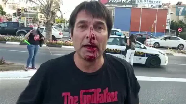 Рон Карми Бузагло