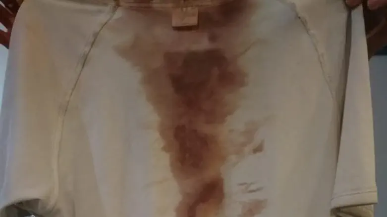 חולצת הצעיר שהותקף